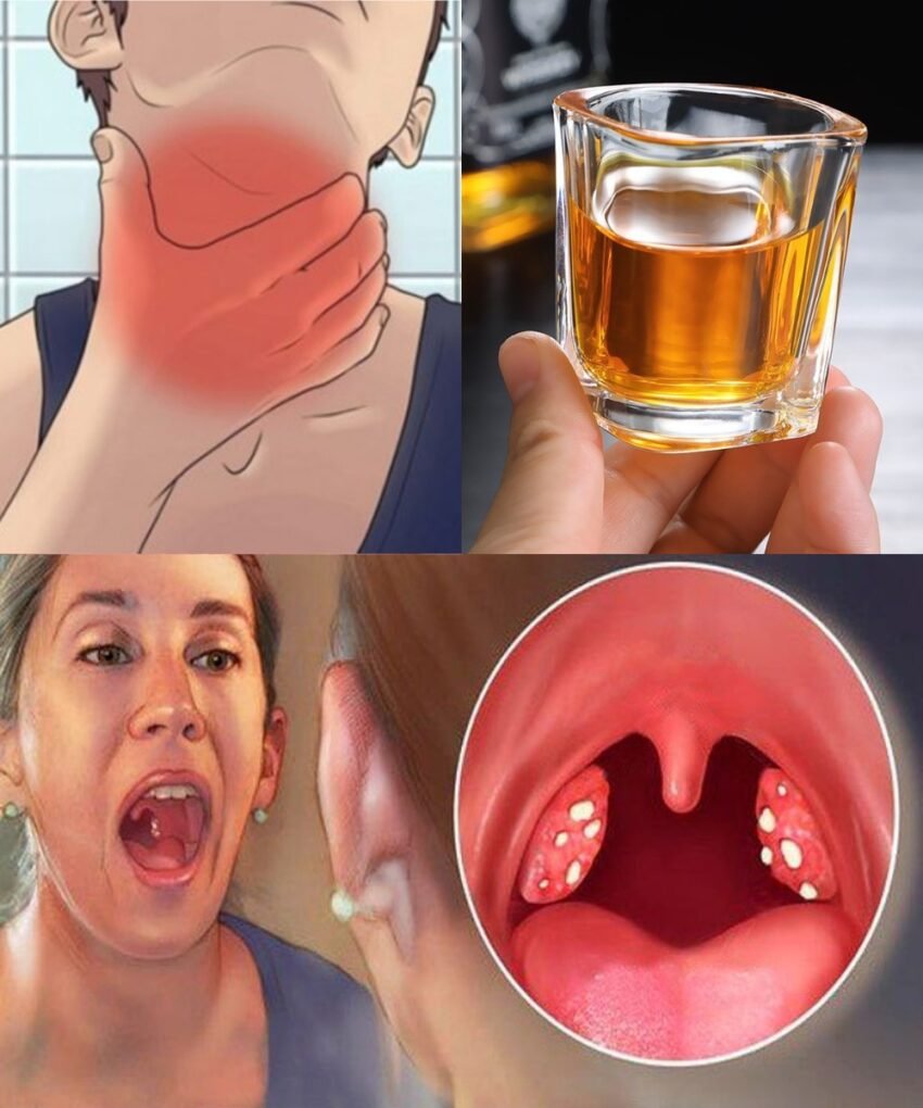 lijek-za-grlo-koji-djeluje-odmah,-a-svi-ga-imate-u-kuci
