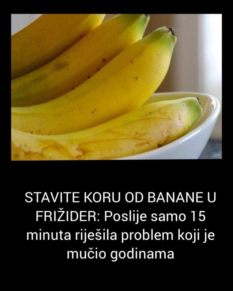 ova-zena-rijesila-problem-u-15-minuta-—-sve-zahvaljujuci-kori-banane!